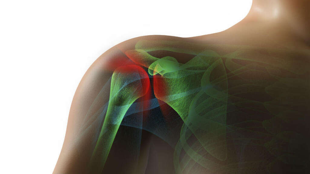 Shoulder Pain