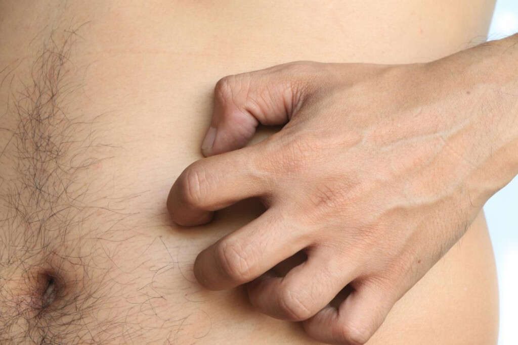 Skin Rash