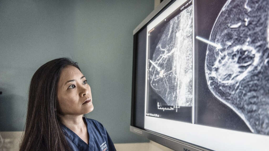 Spinal Stenosis