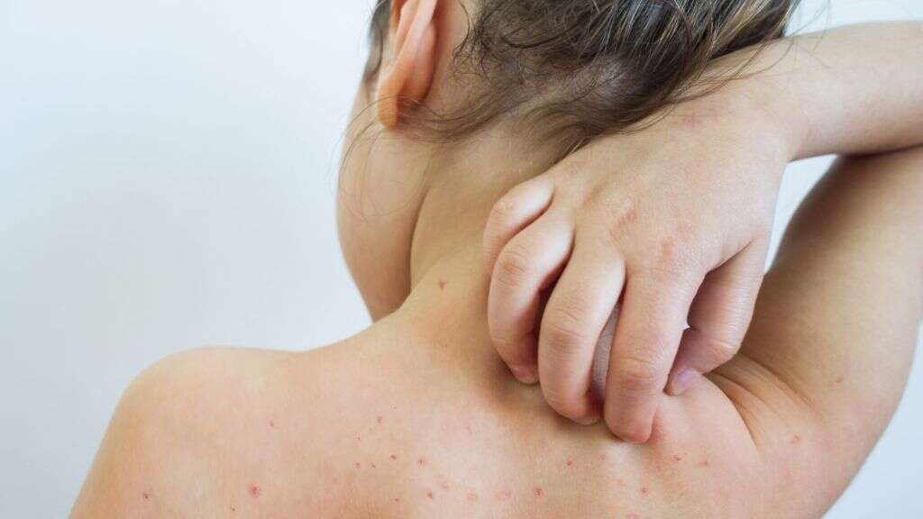 Lymph Nodes