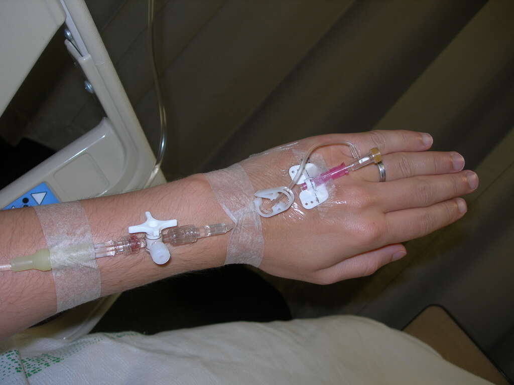 Cellulitis