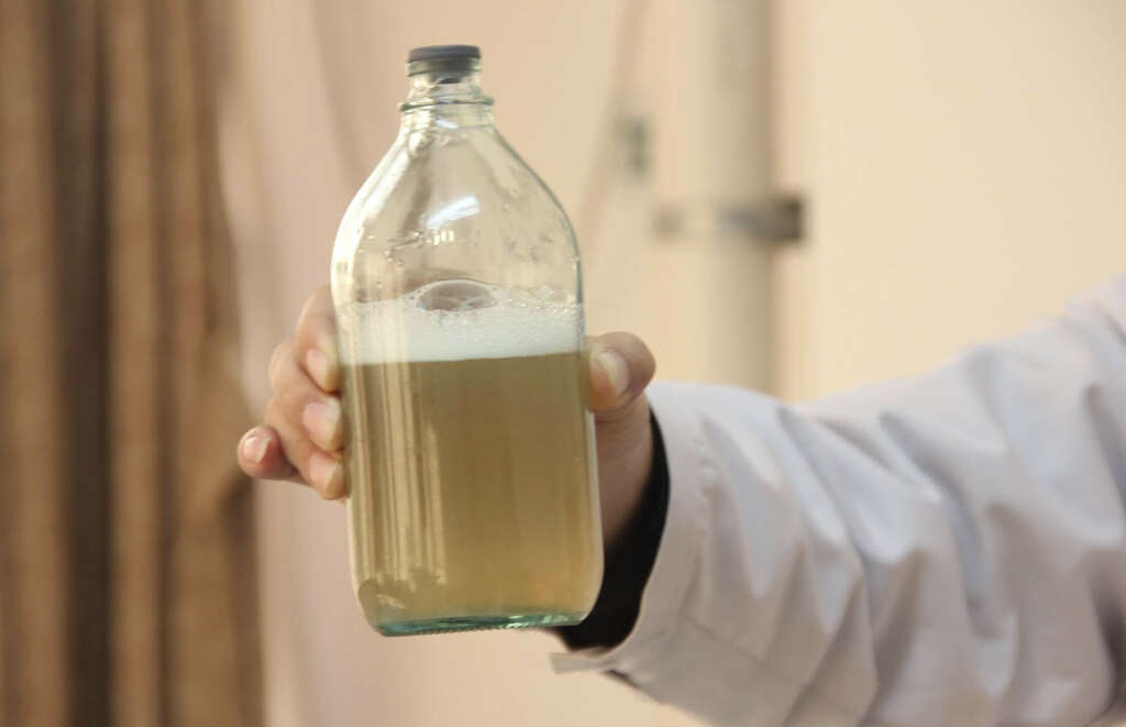 Chronic Kidney Disease