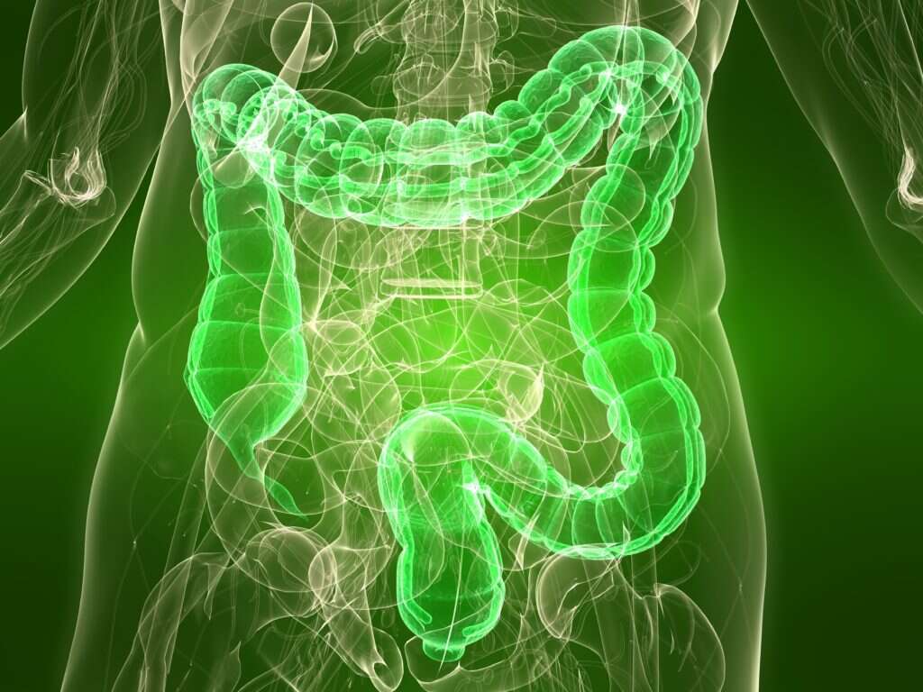 Colon Cancer