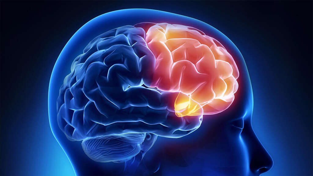 Brain Diseases