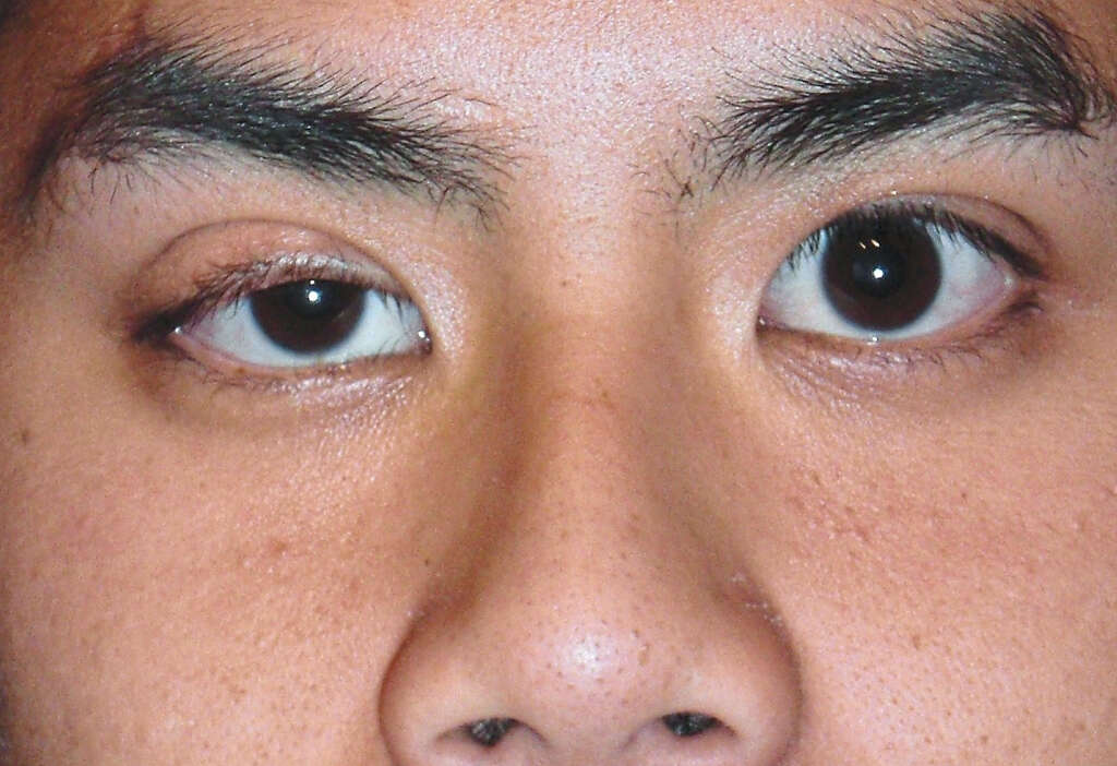 Double Vision