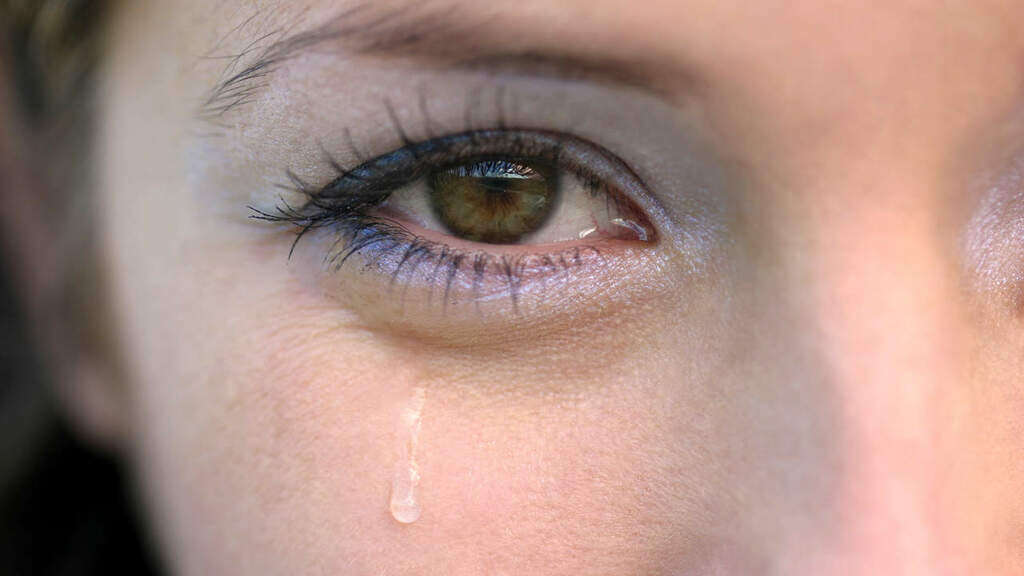 Conjunctivitis