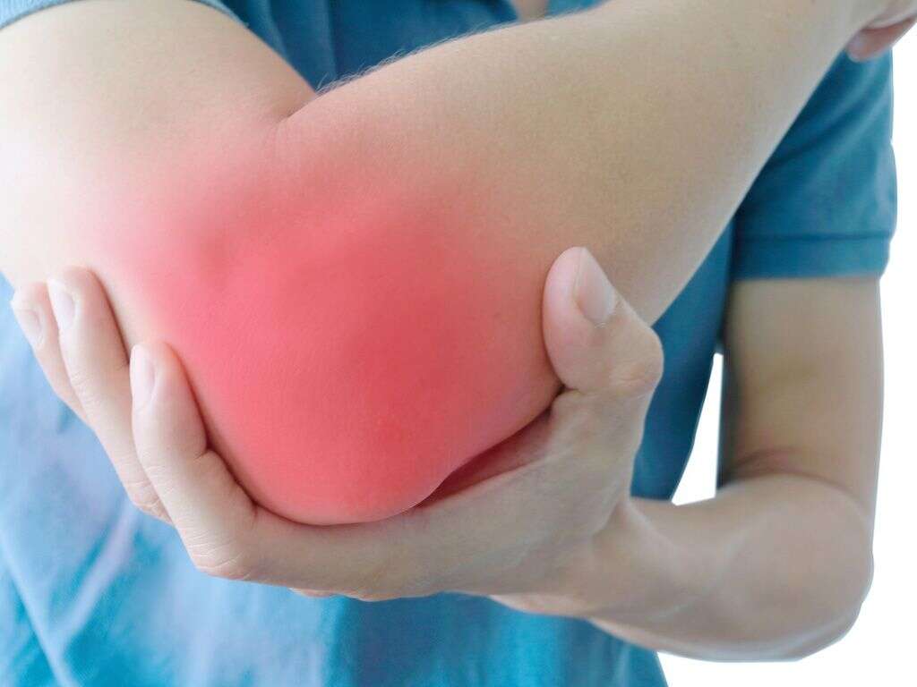 Cubital Tunnel Syndrome