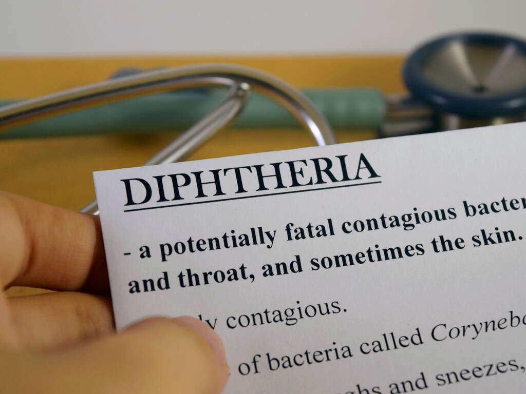 Diphtheria