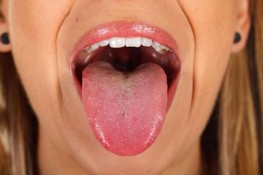 Dysphagia