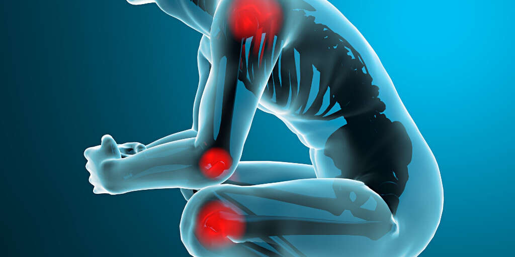 Ehlers Danlos Syndrome