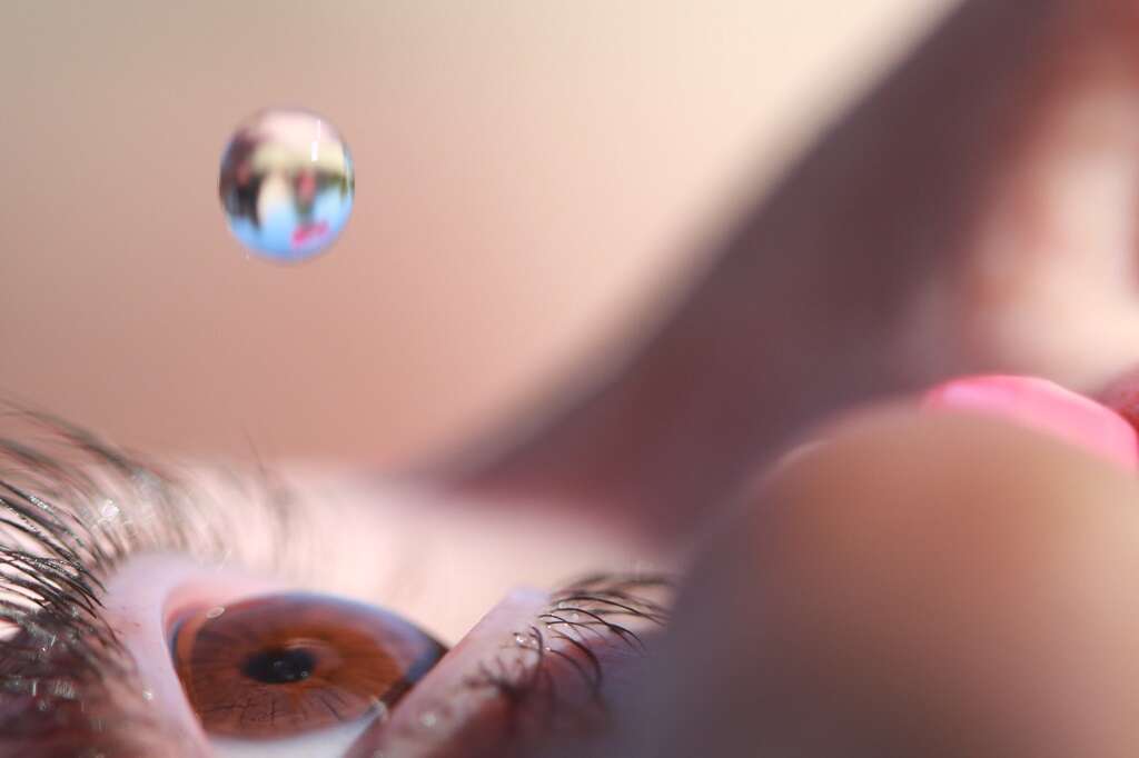 Eye Discharge