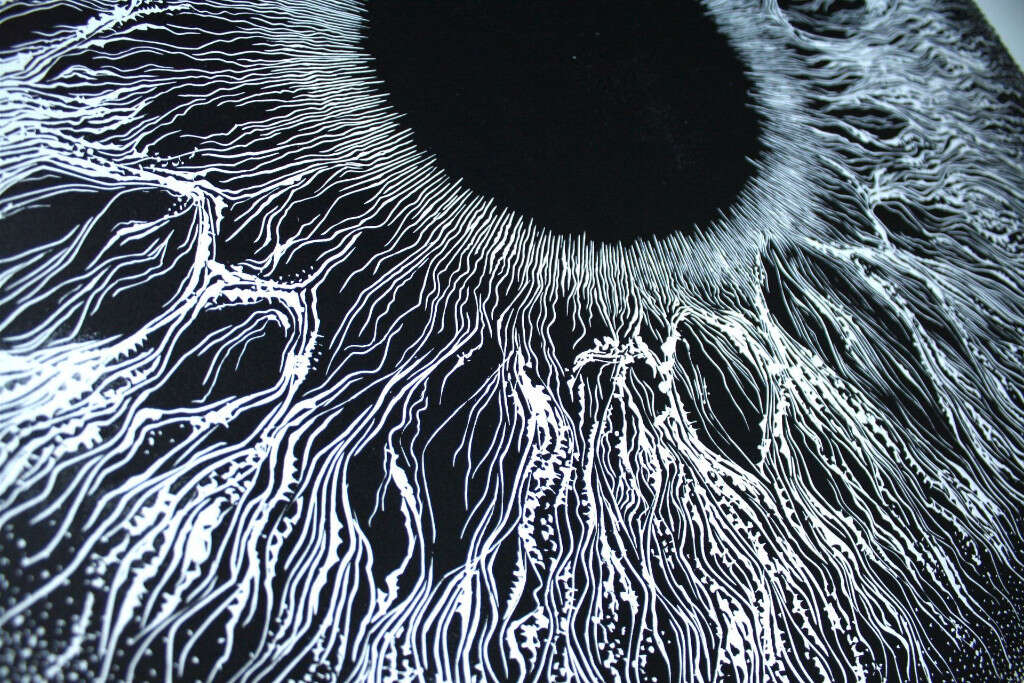 Eye Floaters