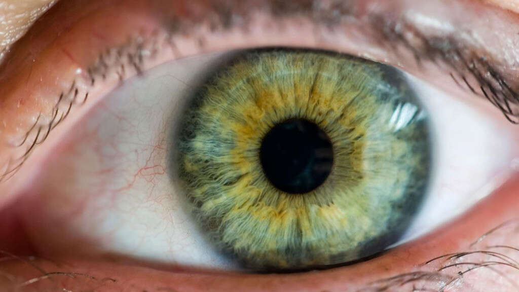 Eye Floaters