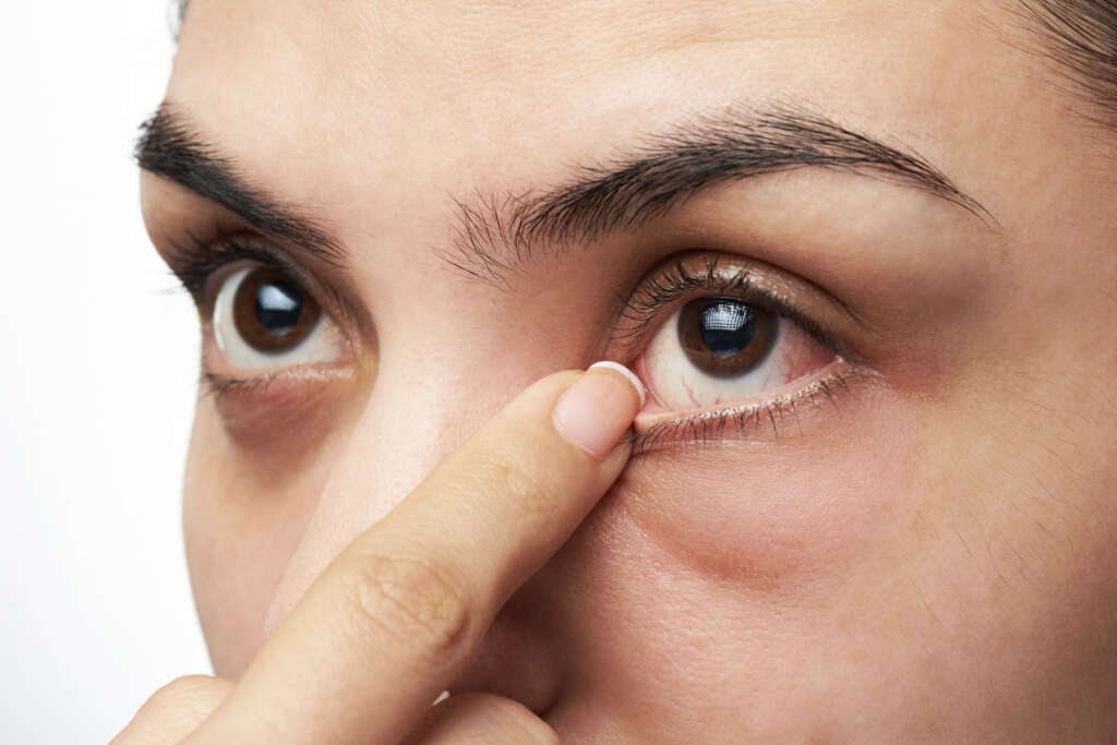 Eye Infection