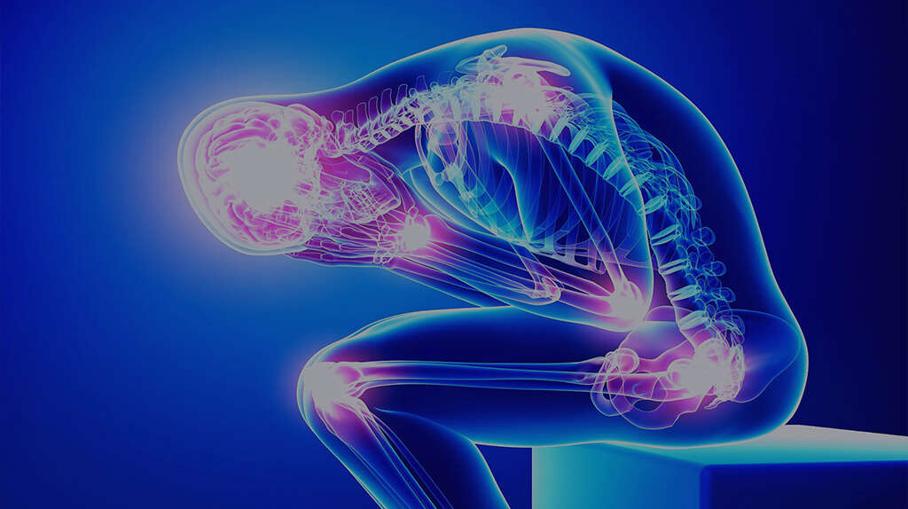 Fibromyalgia