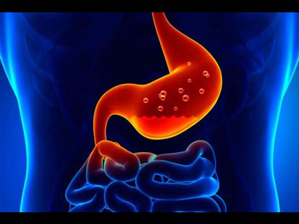 Gastritis