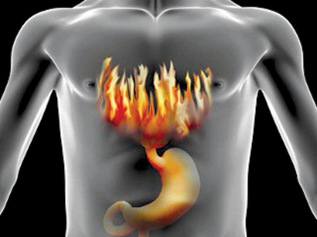 Gastritis