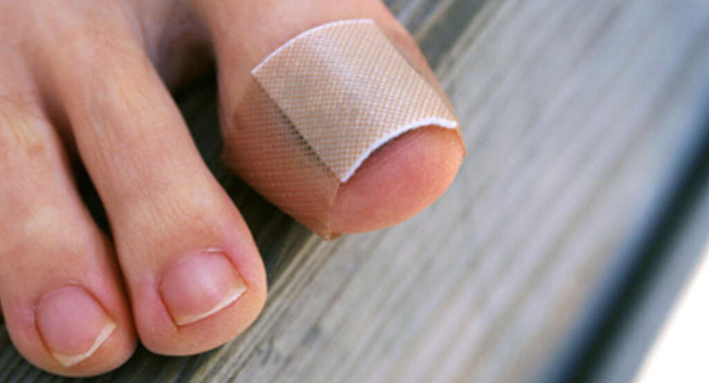 Hammer Toe