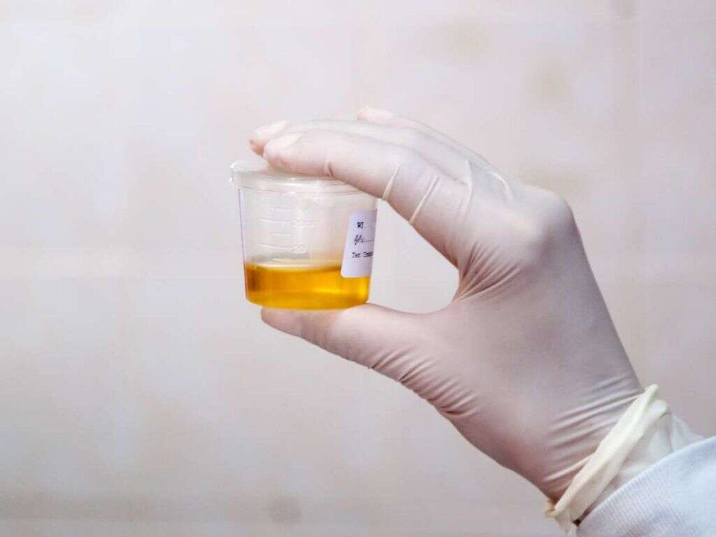 Hantavirus