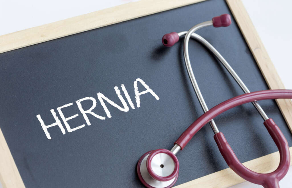 Hiatal Hernia