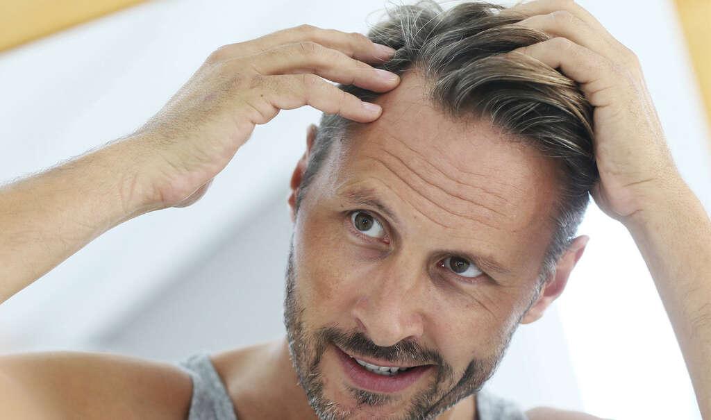 Dry Scalp