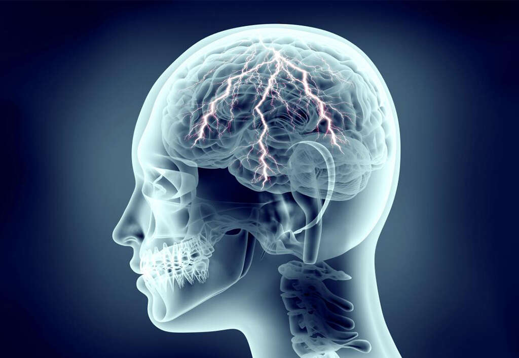Hypocalcemia