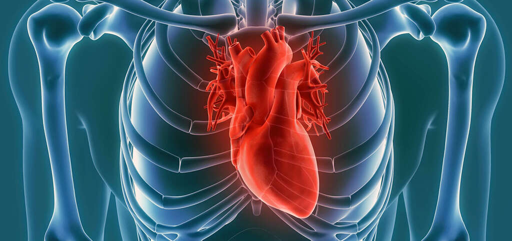 Hypocalcemia