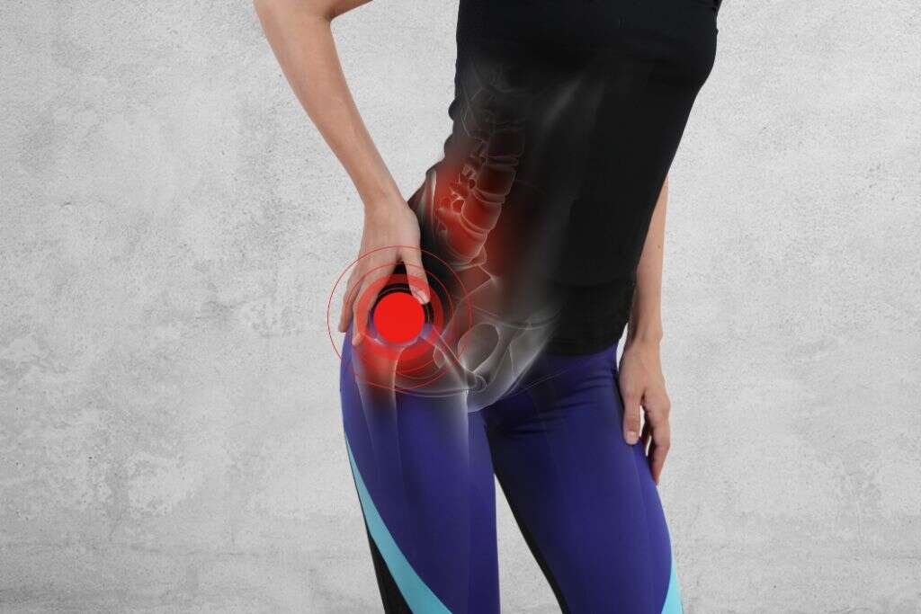Iliotibial Band Syndrome