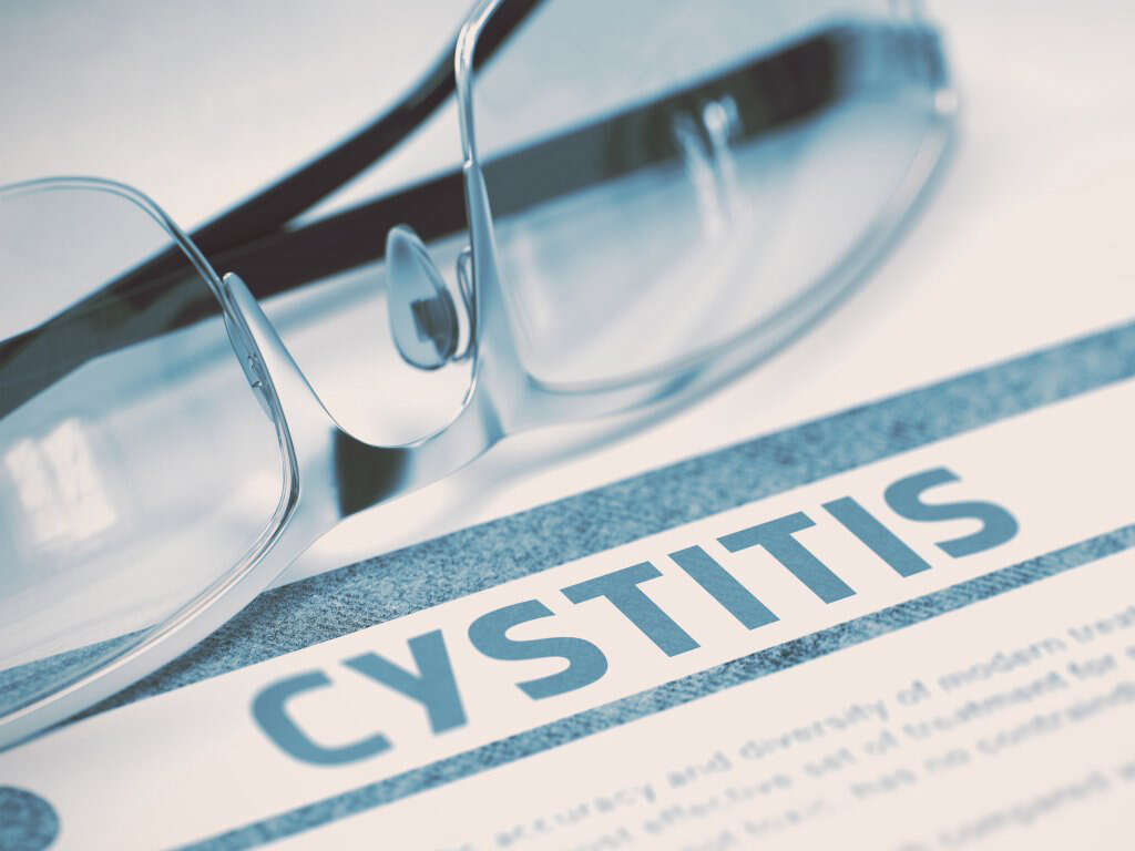 Interstitial Cystitis