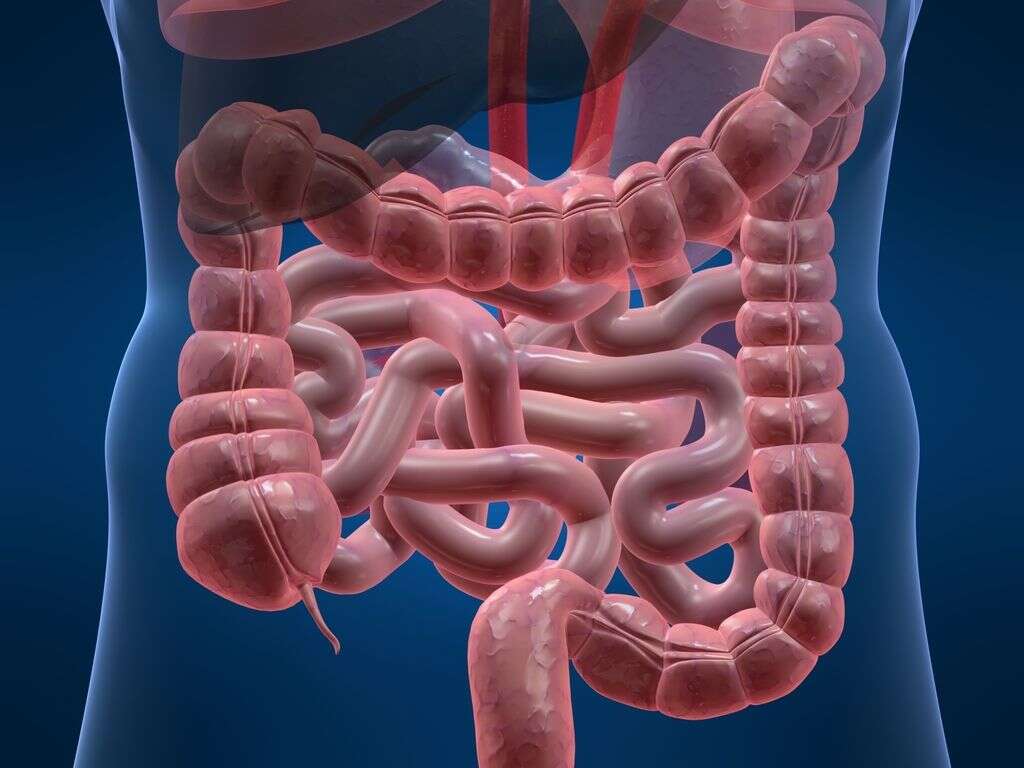 Intestinal Blockage