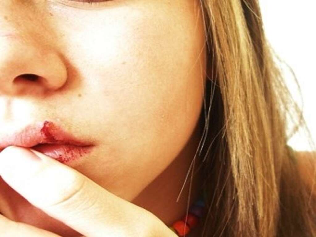 Jaw Cancer