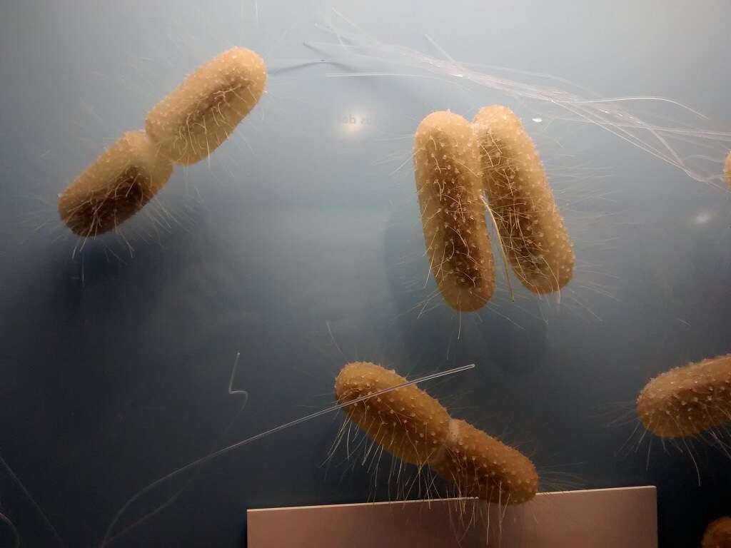 Large Intestine