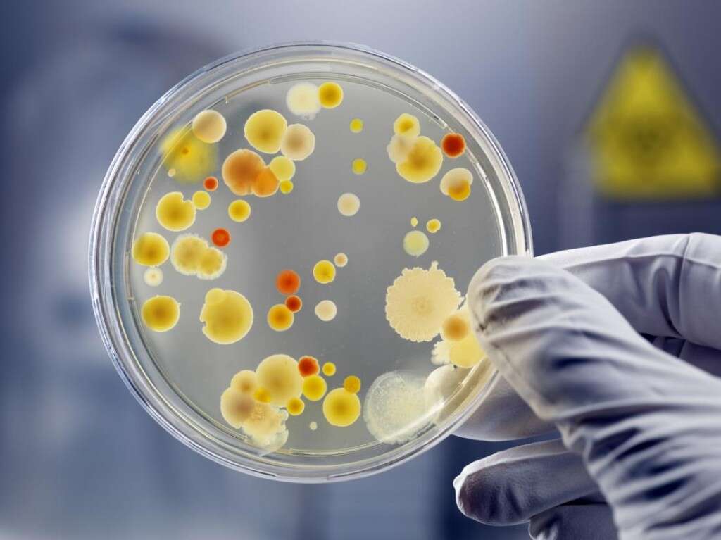 Legionnaires' Disease