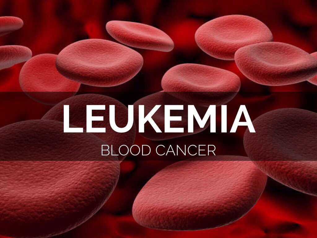 Leukemia