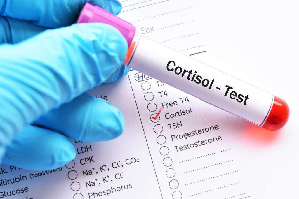 Low Cortisol