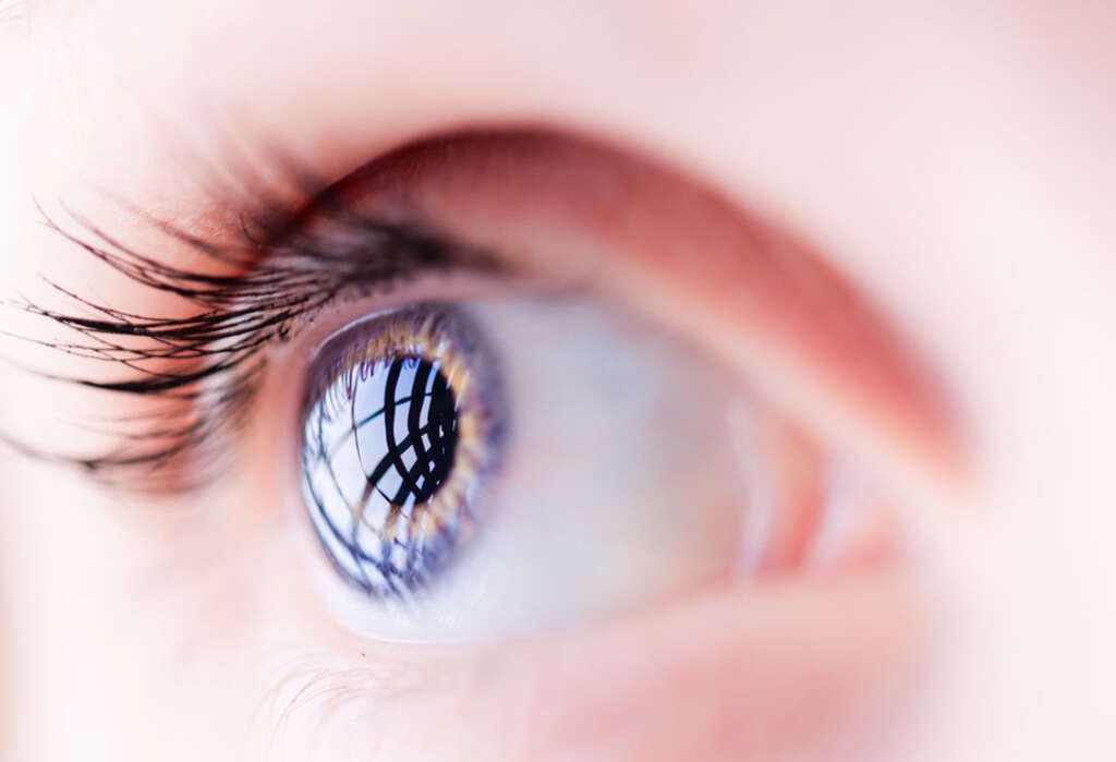 Macular Degeneration