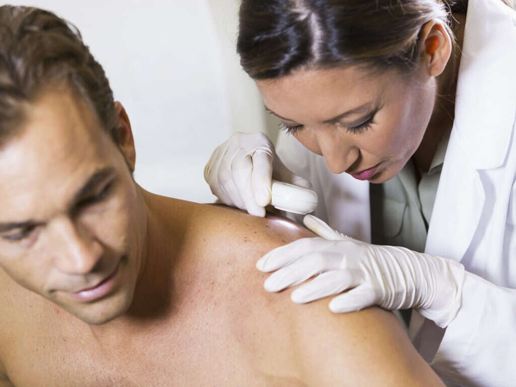 Melanoma