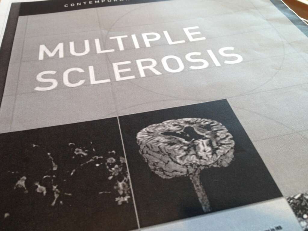 Multiple Sclerosis