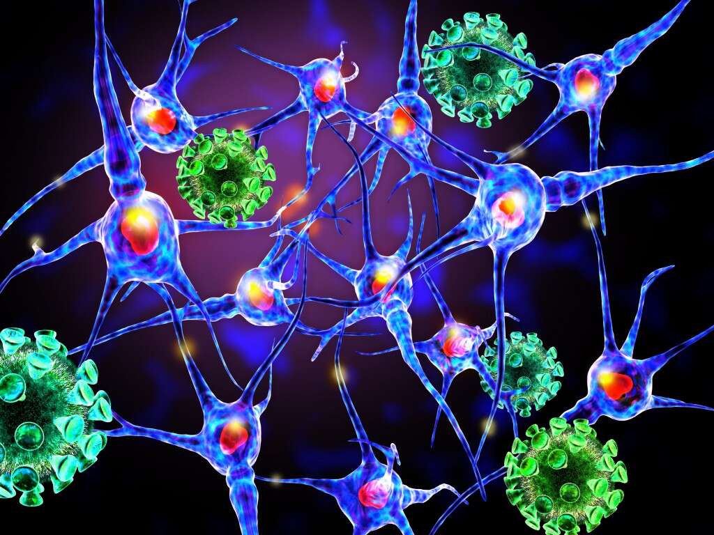 Multiple Sclerosis