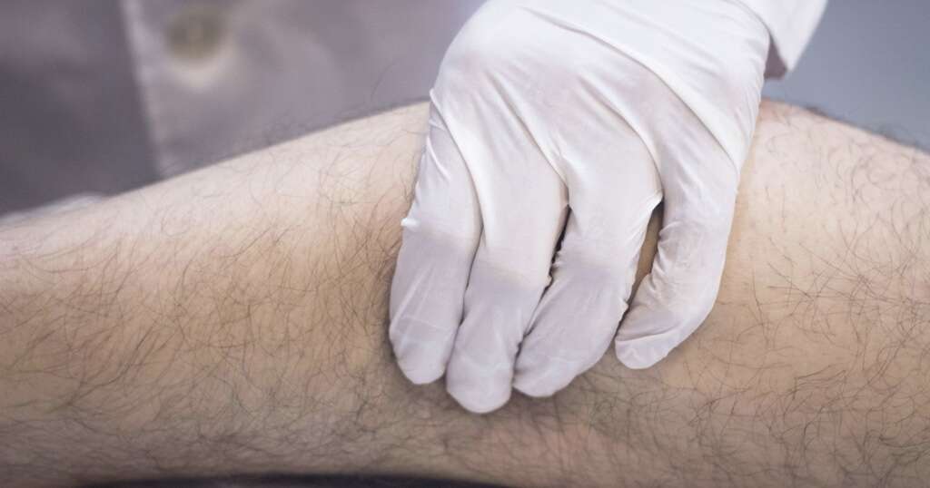 Muscle Strain