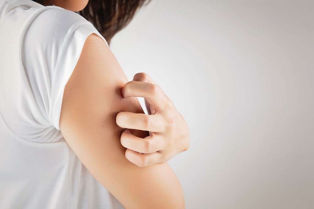 Myositis