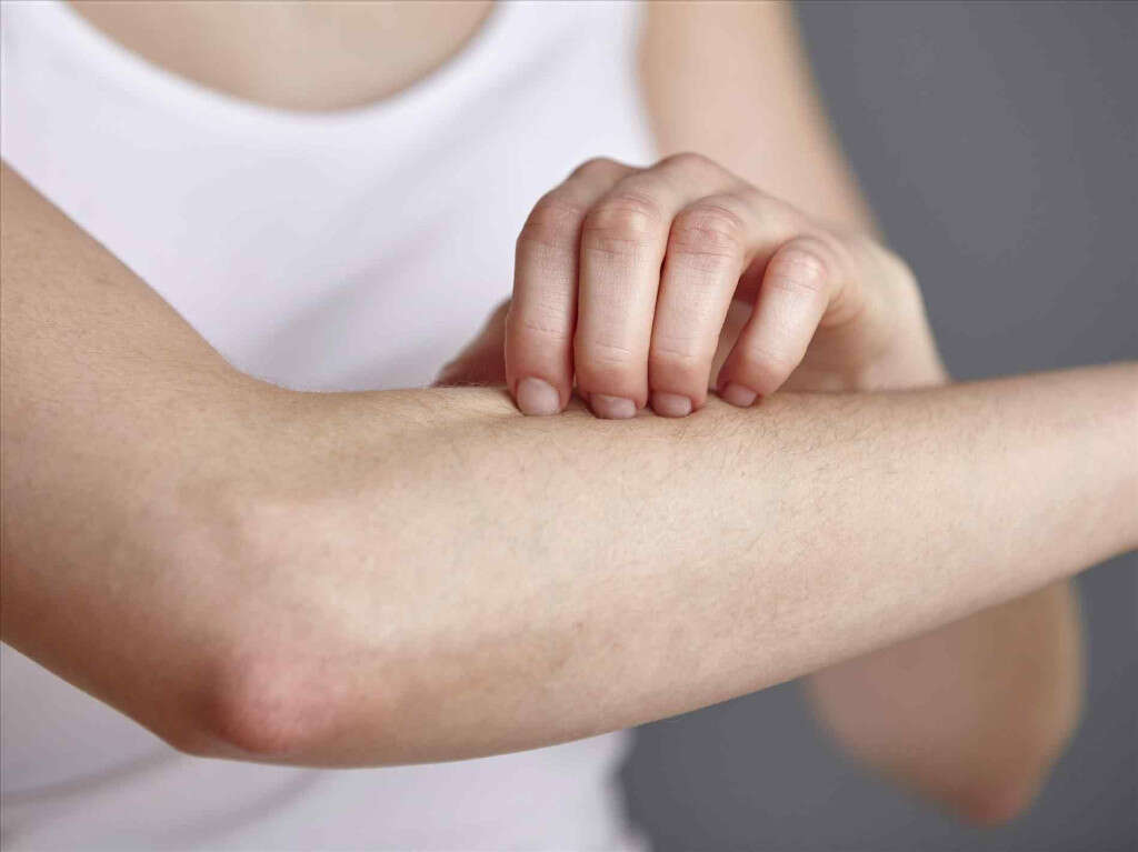 Neurofibromatosis