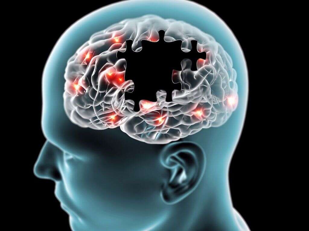 Neuroleptic Malignant Syndrome