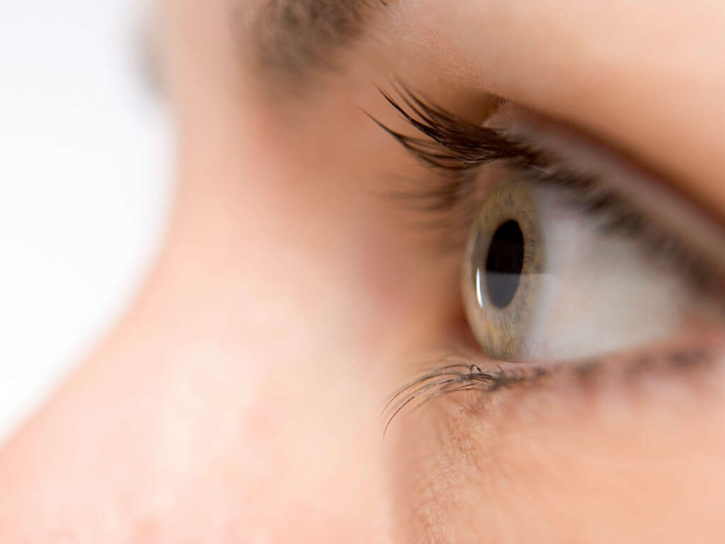 Optic Neuritis