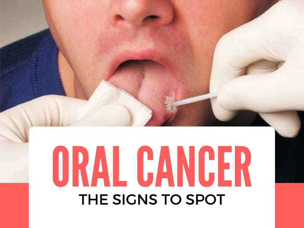 Oral Cancer