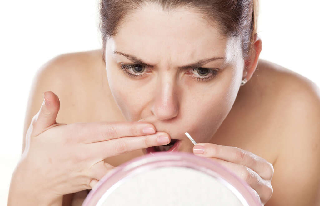 PCOS