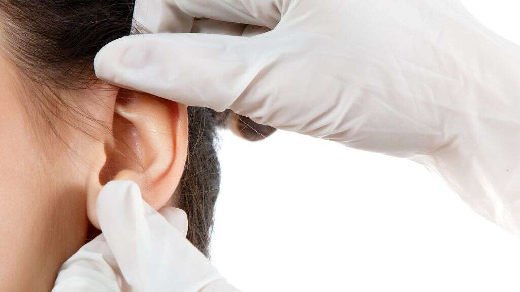 Perforated Eardrum
