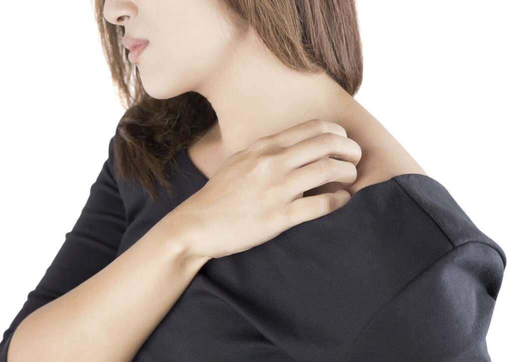 Pityriasis Rosea Facts
