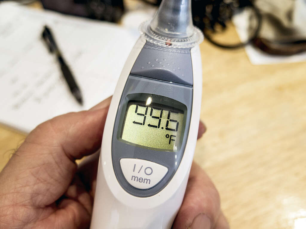 Pleurisy