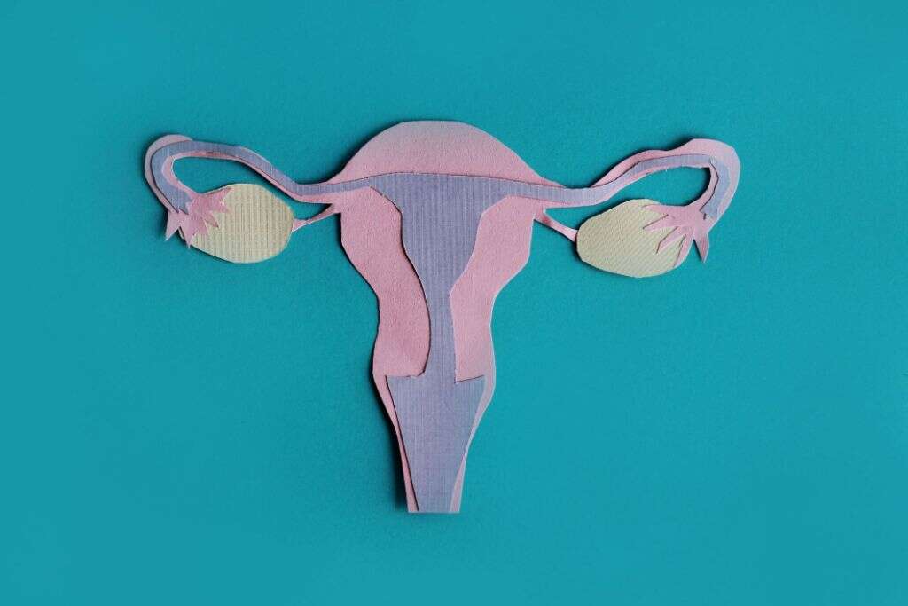 Polycystic Ovary Syndrome